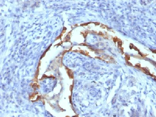 Immunohistochemistry (Formalin/PFA-fixed paraffin-embedded sections) - Anti-Cytokeratin 8 antibody [SPM538] - BSA and Azide free (AB212535)