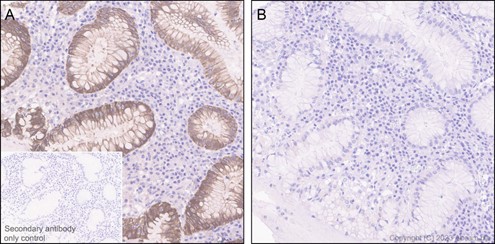 Immunohistochemistry (Formalin/PFA-fixed paraffin-embedded sections) - Anti-Cytokeratin 8 (phospho S23) antibody [EP1629Y] (AB76584)