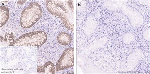 Immunohistochemistry (Formalin/PFA-fixed paraffin-embedded sections) - Anti-Cytokeratin 8 (phospho S23) antibody [EP1629Y] (AB76584)