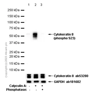 Western blot - Anti-Cytokeratin 8 (phospho S23) antibody [EP1629Y] (AB76584)