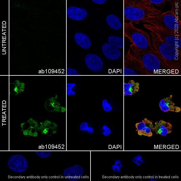 Immunocytochemistry/ Immunofluorescence - Anti-Cytokeratin 8 (phospho S431) antibody [EP1630] (AB109452), expandable thumbnail