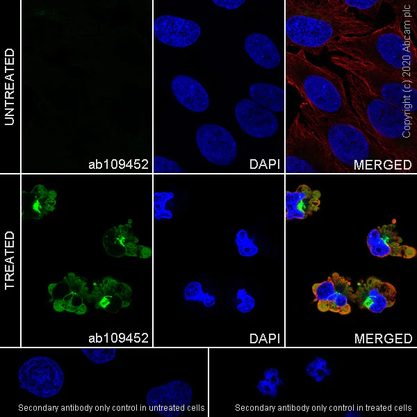 Immunocytochemistry/ Immunofluorescence - Anti-Cytokeratin 8 (phospho S431) antibody [EP1630] (AB109452)