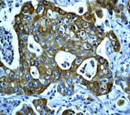 Immunohistochemistry (Formalin/PFA-fixed paraffin-embedded sections) - Anti-Cytokeratin 8 (phospho S431) antibody [EP1630] (AB109452), expandable thumbnail