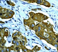 Immunohistochemistry (Formalin/PFA-fixed paraffin-embedded sections) - Anti-Cytokeratin 8 (phospho S431) antibody [EP1630] (AB109452), expandable thumbnail