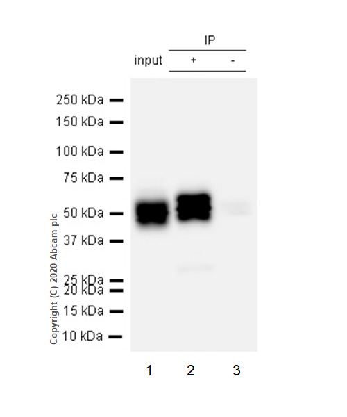 Immunoprecipitation - Anti-Cytokeratin 8 (phospho S431) antibody [EP1630] (AB109452), expandable thumbnail