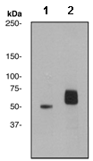Western blot - Anti-Cytokeratin 8 (phospho S431) antibody [EP1630] (AB109452), expandable thumbnail