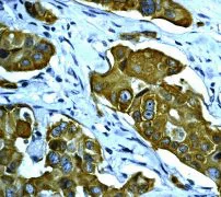 Immunohistochemistry (Formalin/PFA-fixed paraffin-embedded sections) - Anti-Cytokeratin 8 (phospho S431) antibody [EP1630] - BSA and Azide free (AB284783)
