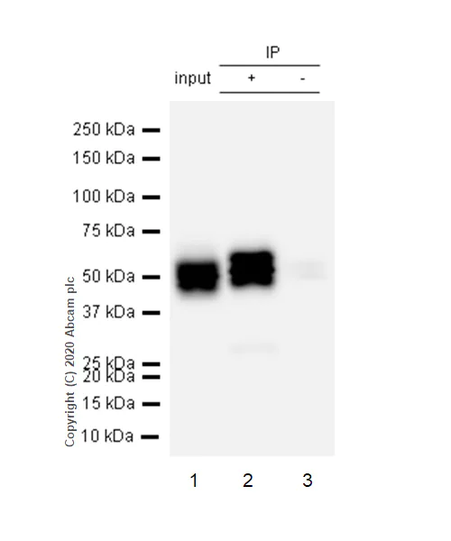 Immunoprecipitation - Anti-Cytokeratin 8 (phospho S431) antibody [EP1630] - BSA and Azide free (AB284783)