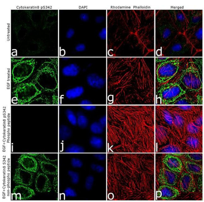 Immunocytochemistry/ Immunofluorescence - Anti-Cytokeratin 8 (phospho S432) Antibody[RP23040156] (AB313459), expandable thumbnail