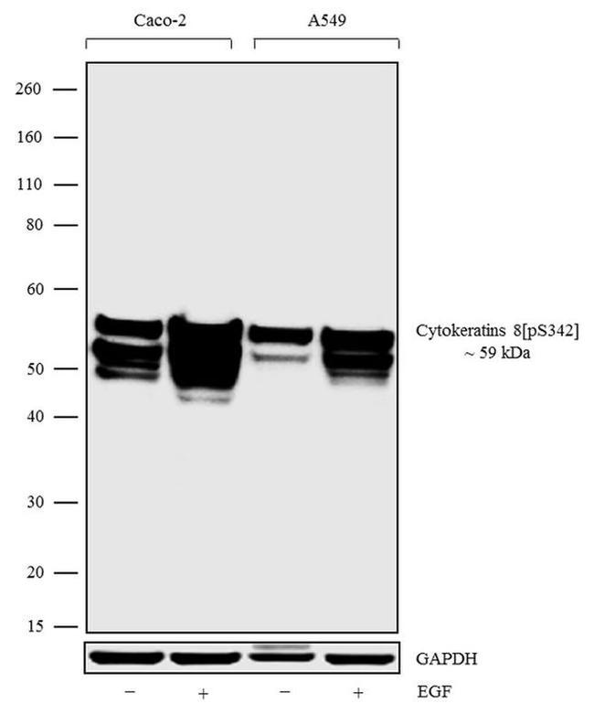 Western blot - Anti-Cytokeratin 8 (phospho S432) Antibody[RP23040156] (AB313459), expandable thumbnail