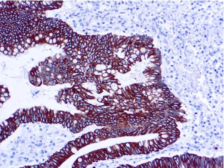 Immunohistochemistry (Formalin/PFA-fixed paraffin-embedded sections) - Anti-Cytokeratin 8+18 antibody [5D3] (AB17139)