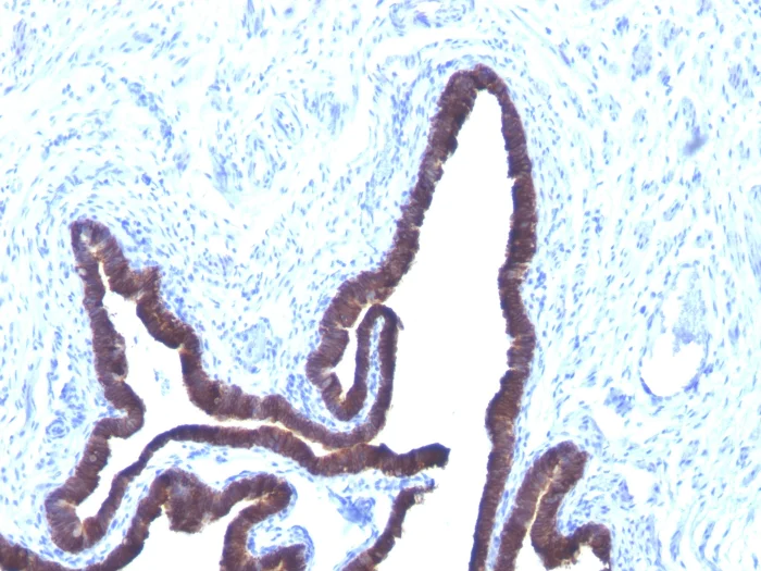 Cytokeratin 8+18抗体[KRT8/803 + KRT18/835] (ab215880)| Abcam中文官网