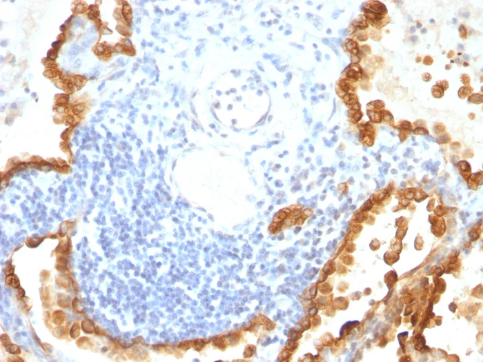 Anti-Cytokeratin 8+18 抗体 [KRT8/803 + KRT18/835] (ab215880) | Abcam