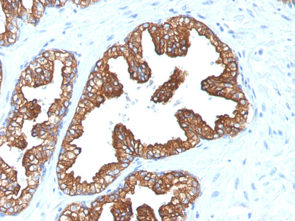 Immunohistochemistry (Formalin/PFA-fixed paraffin-embedded sections) - Anti-Cytokeratin 8+18 antibody [KRT8/803 + KRT18/835] - BSA and Azide free (AB216022), expandable thumbnail