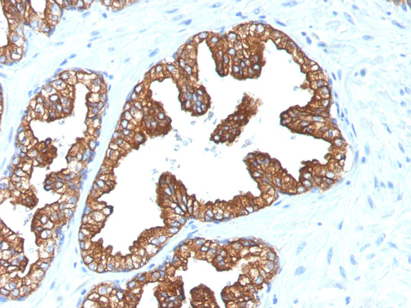 Immunohistochemistry (Formalin/PFA-fixed paraffin-embedded sections) - Anti-Cytokeratin 8+18 antibody [KRT8/803 + KRT18/835] - BSA and Azide free (AB216022)