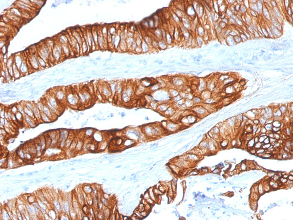 Immunohistochemistry (Formalin/PFA-fixed paraffin-embedded sections) - Anti-Cytokeratin 8+18 antibody [KRT8/803 + KRT18/835] - BSA and Azide free (AB216022), expandable thumbnail