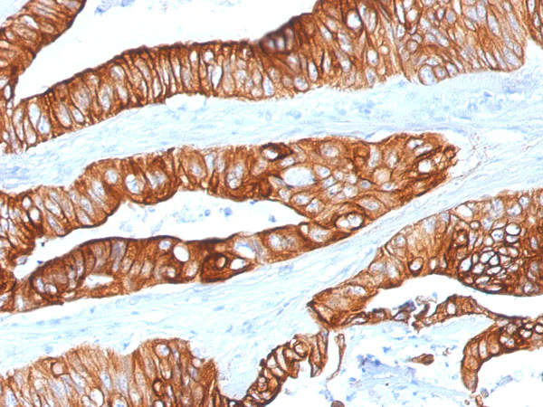 洋楽 CYTOTOXIN Cytotoxic T Cells: Mechanisms, Activation, and Their Role in