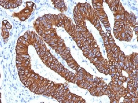 Immunohistochemistry (Formalin/PFA-fixed paraffin-embedded sections) - Anti-Cytokeratin 8+18 antibody [KRT8.18/1346] (AB219335)