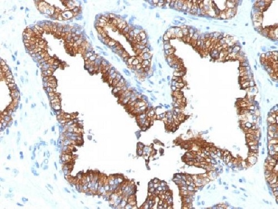 Immunohistochemistry (Formalin/PFA-fixed paraffin-embedded sections) - Anti-Cytokeratin 8+18 antibody [KRT8.18/1346] - BSA and Azide free (AB269768)