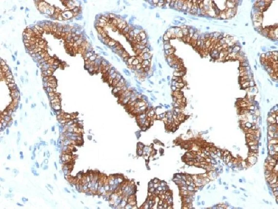 Immunohistochemistry (Formalin/PFA-fixed paraffin-embedded sections) - Anti-Cytokeratin 8+18 antibody [KRT8.18/1346] - BSA and Azide free (AB269768)