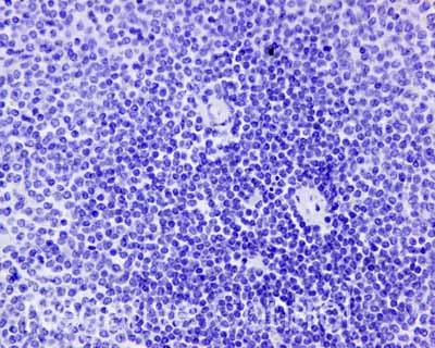 Immunohistochemistry (Formalin/PFA-fixed paraffin-embedded sections) - Anti-Cytokeratin 9 antibody [EPR10932-62] (AB171966)