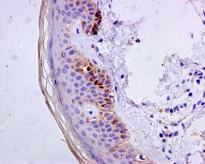Immunohistochemistry (Formalin/PFA-fixed paraffin-embedded sections) - Anti-Cytokeratin 9 antibody [EPR10932-62] (AB171966), expandable thumbnail