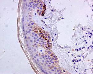 Immunohistochemistry (Formalin/PFA-fixed paraffin-embedded sections) - Anti-Cytokeratin 9 antibody [EPR10932-62] (AB171966)