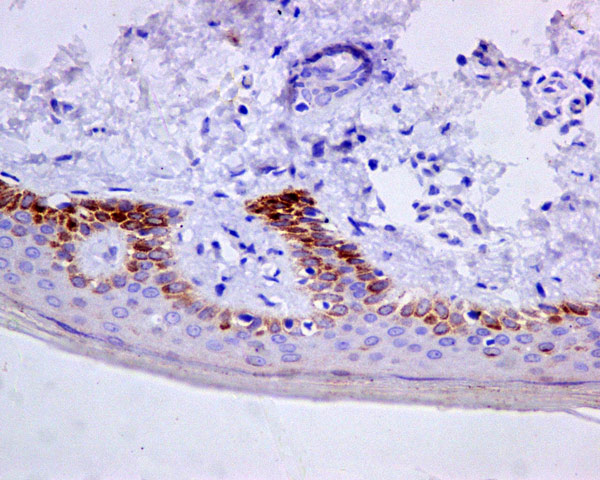 Immunohistochemistry (Formalin/PFA-fixed paraffin-embedded sections) - Anti-Cytokeratin 9 antibody [EPR10932-62] (AB171966), expandable thumbnail