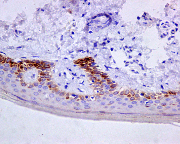 Immunohistochemistry (Formalin/PFA-fixed paraffin-embedded sections) - Anti-Cytokeratin 9 antibody [EPR10932-62] (AB171966)