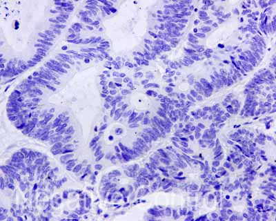 Immunohistochemistry (Formalin/PFA-fixed paraffin-embedded sections) - Anti-Cytokeratin 9 antibody [EPR10932-62] (ab171966), expandable thumbnail