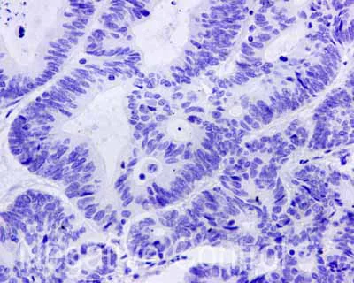 Immunohistochemistry (Formalin/PFA-fixed paraffin-embedded sections) - Anti-Cytokeratin 9 antibody [EPR10932-62] (AB171966)