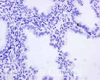 Immunohistochemistry (Formalin/PFA-fixed paraffin-embedded sections) - Anti-Cytokeratin 9 antibody [EPR10932-62] (AB171966)
