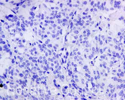 Immunohistochemistry (Formalin/PFA-fixed paraffin-embedded sections) - Anti-Cytokeratin 9 antibody [EPR10932-62] (ab171966), expandable thumbnail