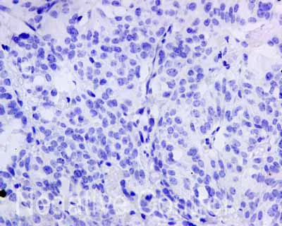 Immunohistochemistry (Formalin/PFA-fixed paraffin-embedded sections) - Anti-Cytokeratin 9 antibody [EPR10932-62] (AB171966)