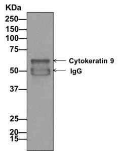 Immunoprecipitation - Anti-Cytokeratin 9 antibody [EPR10932-62] (ab171966), expandable thumbnail