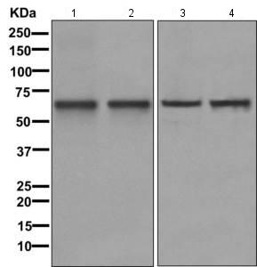 Western blot - Anti-Cytokeratin 9 antibody [EPR10932-62] (AB171966), expandable thumbnail