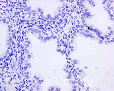 Immunohistochemistry (Formalin/PFA-fixed paraffin-embedded sections) - Anti-Cytokeratin 9 antibody [EPR10932-62] - BSA and Azide free (AB240165)