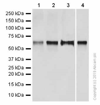 Western blot - Anti-Cytokeratin 9 antibody [EPR10932] - BSA and Azide free (AB249416), expandable thumbnail