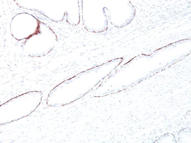 Immunohistochemistry (Formalin/PFA-fixed paraffin-embedded sections) - Anti-Cytokeratin antibody [34BE12] (AB191208)