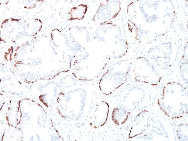 Immunohistochemistry (Formalin/PFA-fixed paraffin-embedded sections) - Anti-Cytokeratin antibody [34BE12] (AB191208)