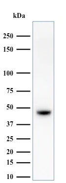 Western blot - Anti-Cytokeratin antibody [34BE12] (AB191208)
