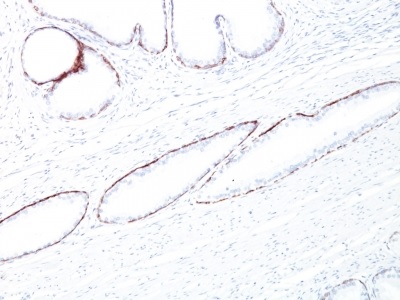 Immunohistochemistry (Formalin/PFA-fixed paraffin-embedded sections) - Anti-Cytokeratin antibody [34BE12] - BSA and Azide free (AB213134)