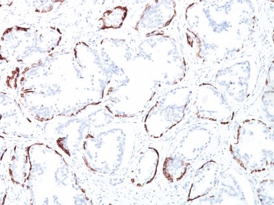 Immunohistochemistry (Formalin/PFA-fixed paraffin-embedded sections) - Anti-Cytokeratin antibody [34BE12] - BSA and Azide free (AB213134)