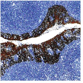Immunohistochemistry (Formalin/PFA-fixed paraffin-embedded sections) - Anti-Cytokeratin antibody [MNF116], prediluted (AB82612), expandable thumbnail