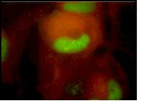 Immunocytochemistry/ Immunofluorescence - Anti-Cytomegalovirus antibody [6F12] (AB6500)