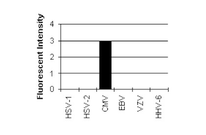 Immunocytochemistry/ Immunofluorescence - Anti-Cytomegalovirus antibody [6F12] (AB6500)