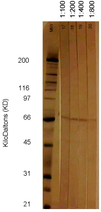Western blot - Anti-Cytomegalovirus antibody [6F12] (AB6500)