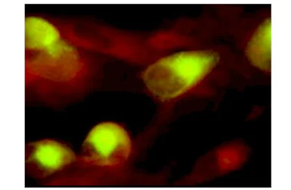 Immunocytochemistry/ Immunofluorescence - Anti-Cytomegalovirus Glycoprotein B antibody [2F12] (AB6499)