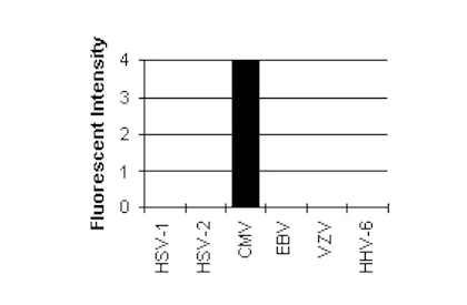 Immunocytochemistry/ Immunofluorescence - Anti-Cytomegalovirus Glycoprotein B antibody [2F12] (AB6499)