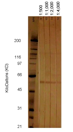 Western blot - Anti-Cytomegalovirus Glycoprotein B antibody [2F12] (AB6499)